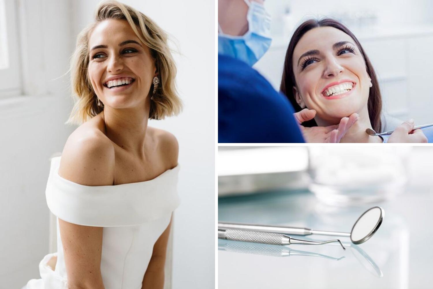 Эстетическая стоматология: фото невесты